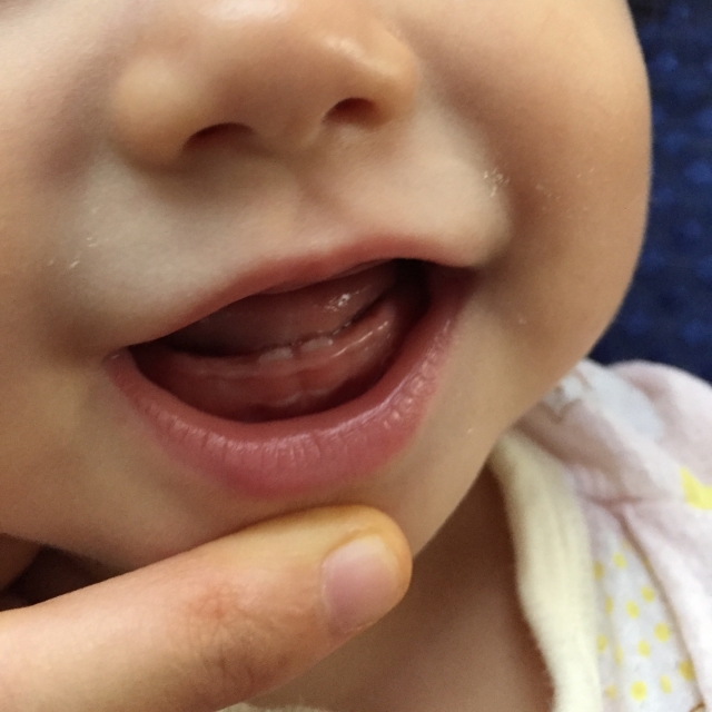 赤ちゃんのお口と歯の健康-13